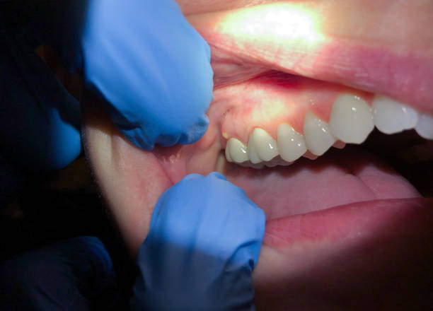 Best Urgent Tooth Repair  in Middletown, KY